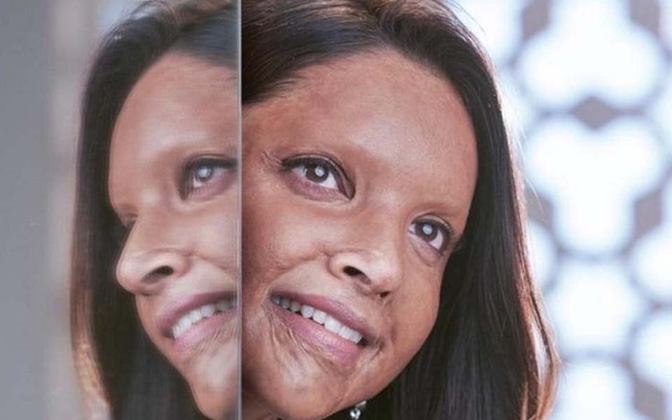 Fact Check: 'Chhapaak' trends on Twitter- and no its screen villain is neither 'Nadeem' nor 'Rajesh'