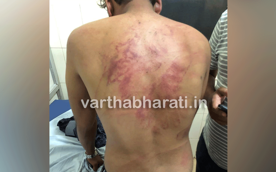 Mangaluru: Youth kidnapped, assaulted and looted
