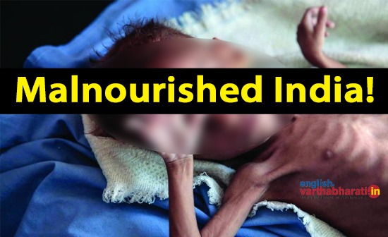 Malnourished India!