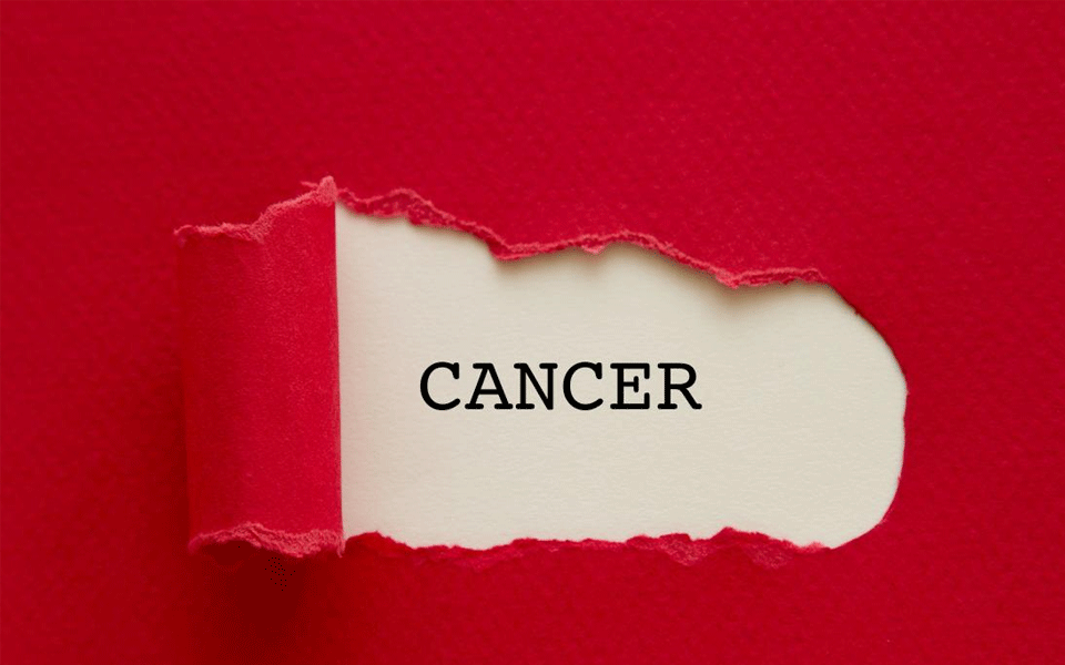 Younger population now falling prey to head and neck cancer: Experts