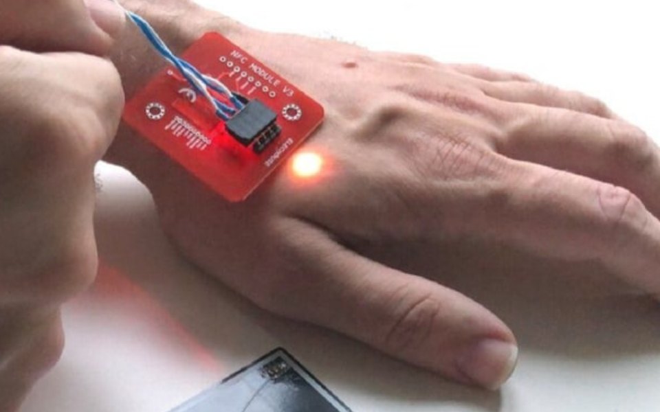 Probe man's claim of account hacking through microchip in body, court tells cops