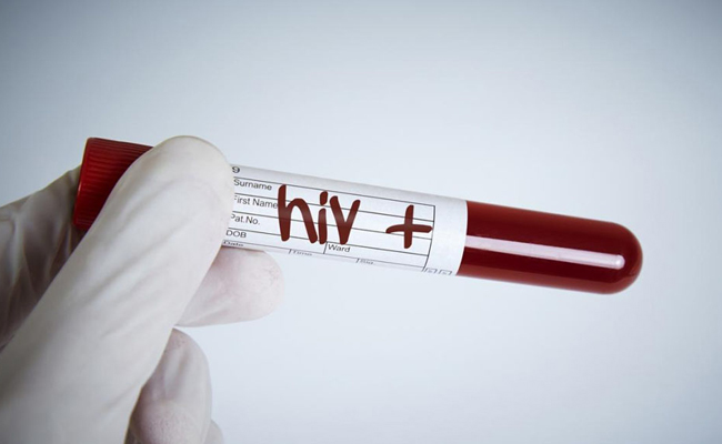 47 students die of HIV in Tripura, 828 test positive