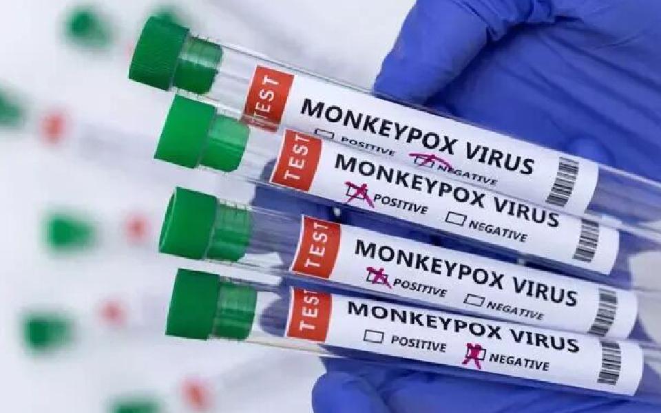 Mpox confirmed in man who travelled from country experiencing disease spread: Govt