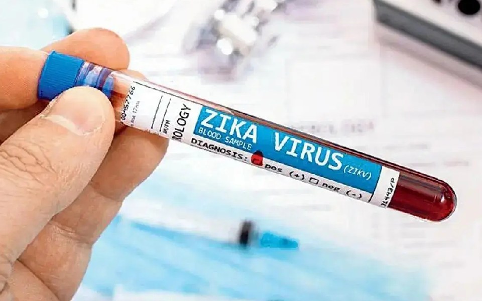 Suspected Zika case: Sample from Andhra sent to NIV Pune for confirmation