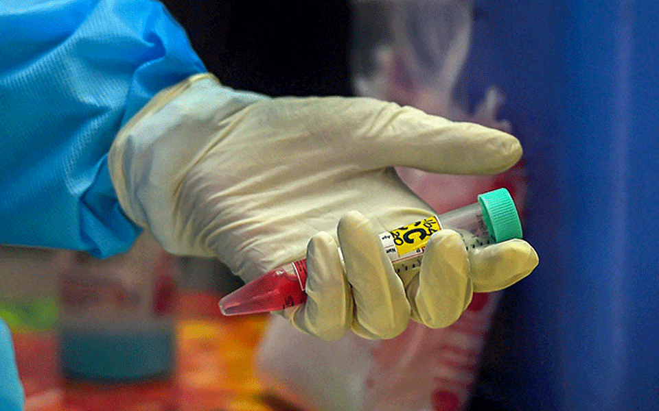 11,713 new cases take India's coronavirus tally to 1,08,14,304