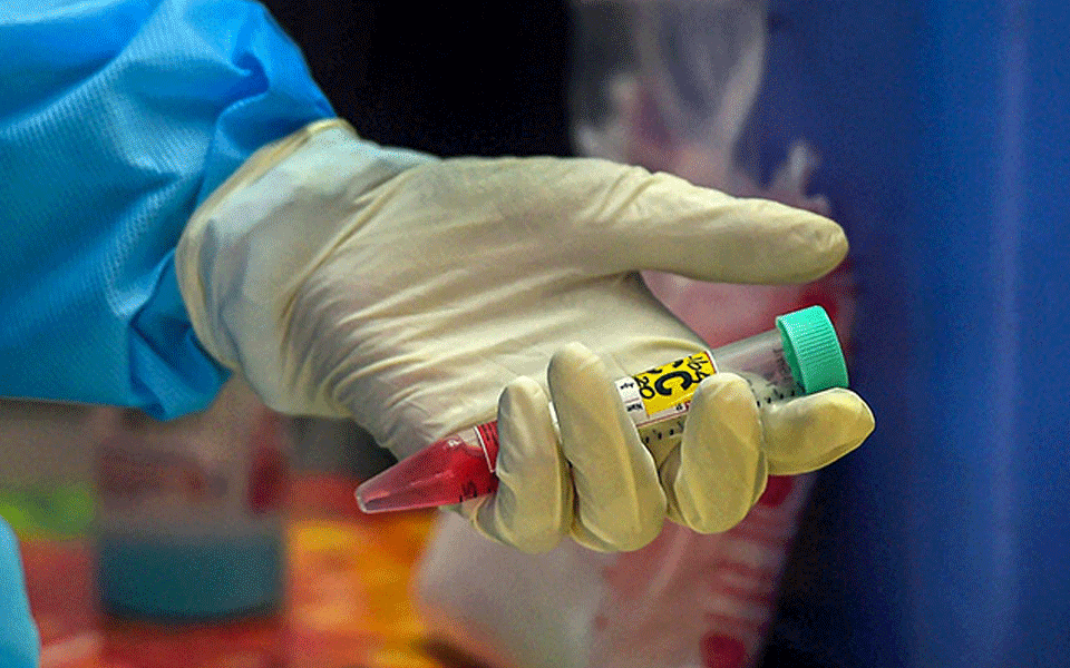 India's active caseload has shrunk to 4,80,719: Health Ministry