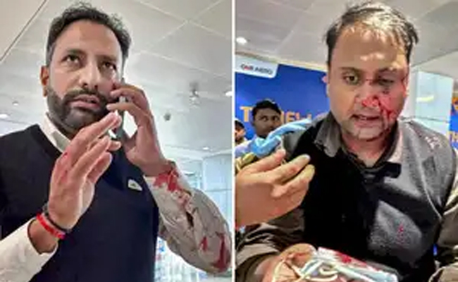 Passenger beaten by off-duty Air India Express pilot suffers nasal fracture, seeks justice