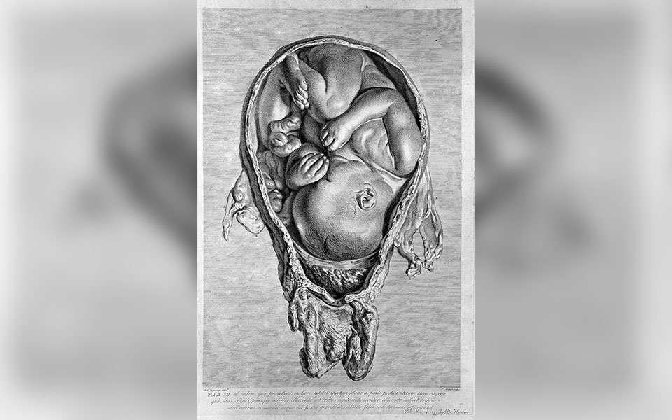 Female foetus not acceptable yet!?