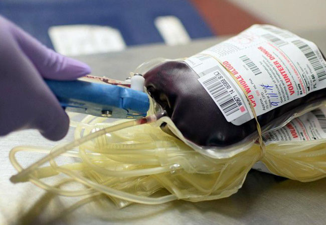 14 children contract Hepatitis, HIV infections during blood transfusions in UP hospital