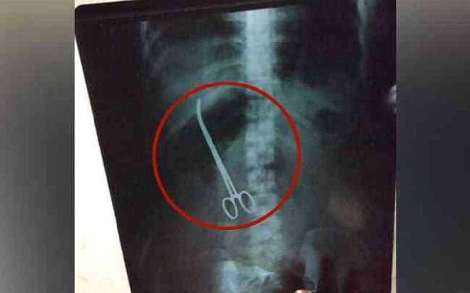 Chest X Ray Charges In Karachi Printable Templates