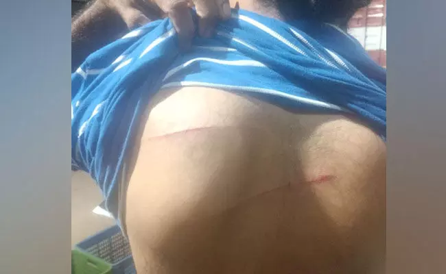 Ullal: Youngster attacked with deadly weapon