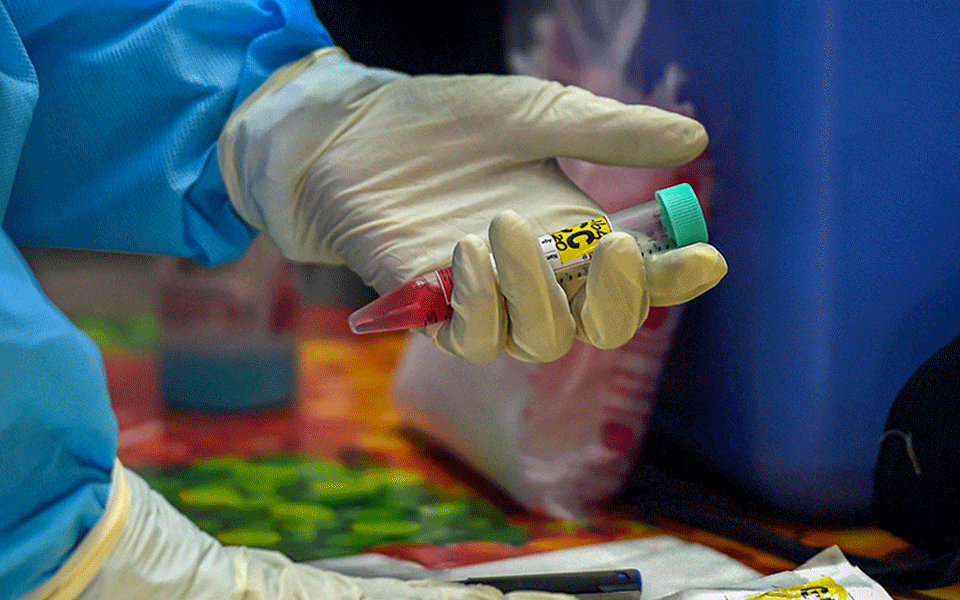 Three COVID-19 related deaths in Udupi since Tuesday