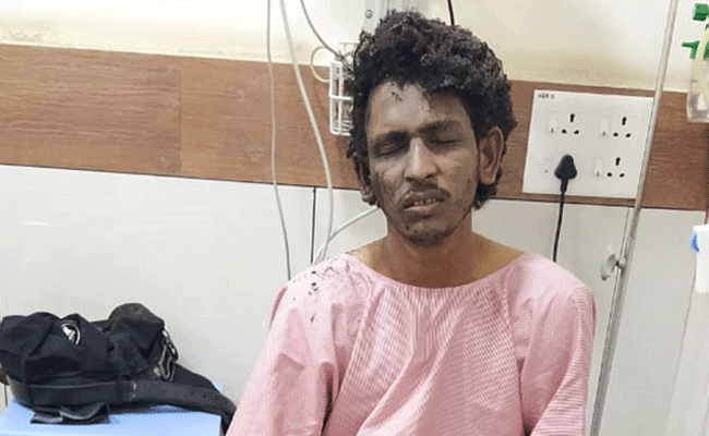 Mangaluru: Cooker bomb blast accused shifted to Bengaluru