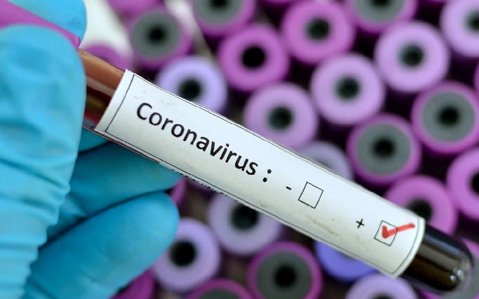 Covid-19: Karnataka records 87 positive cases