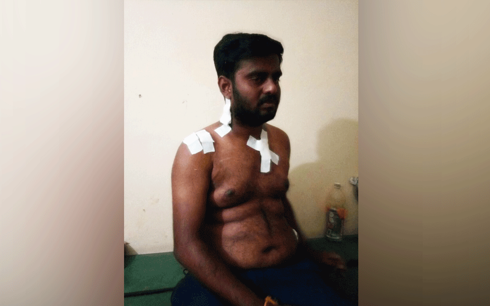 Turuvekere: Dalit youth assaulted by gang