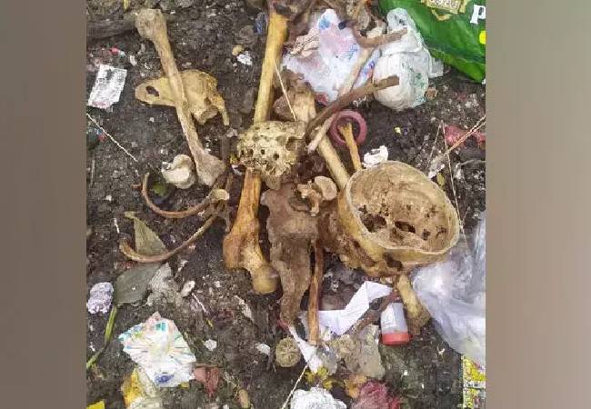 Bengaluru: Human bones found in garbage heap in Electronic City, man admits to dumping them