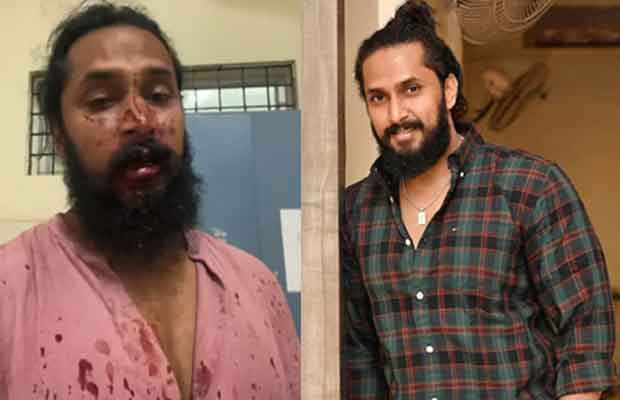 Kannada actor Chetan Chandra allegedly assaulted by unknown assailants