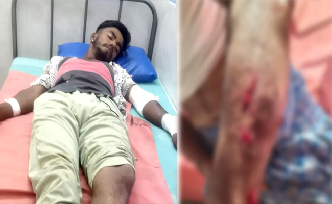 Leopard attacks three in Shivamogga, two seriously injured