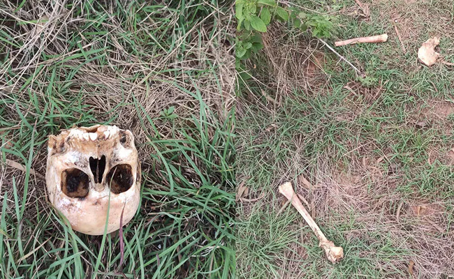 Human skeletal remains found in Bengaluru outskirts