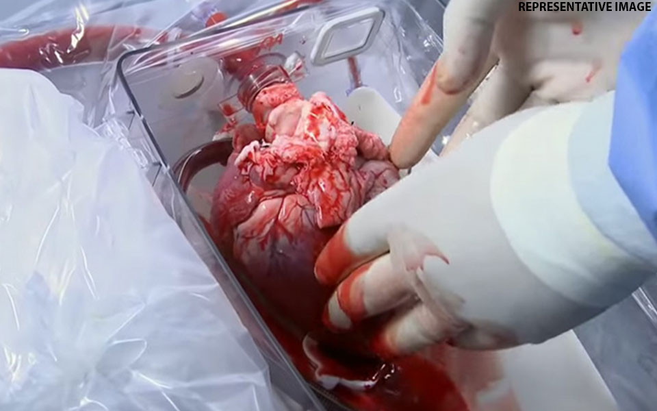 First human-to-human heart transplant in eastern India