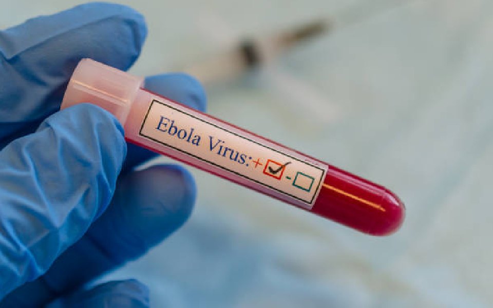 A nurse in Uganda died from Ebola virus, first outbreak since 2022