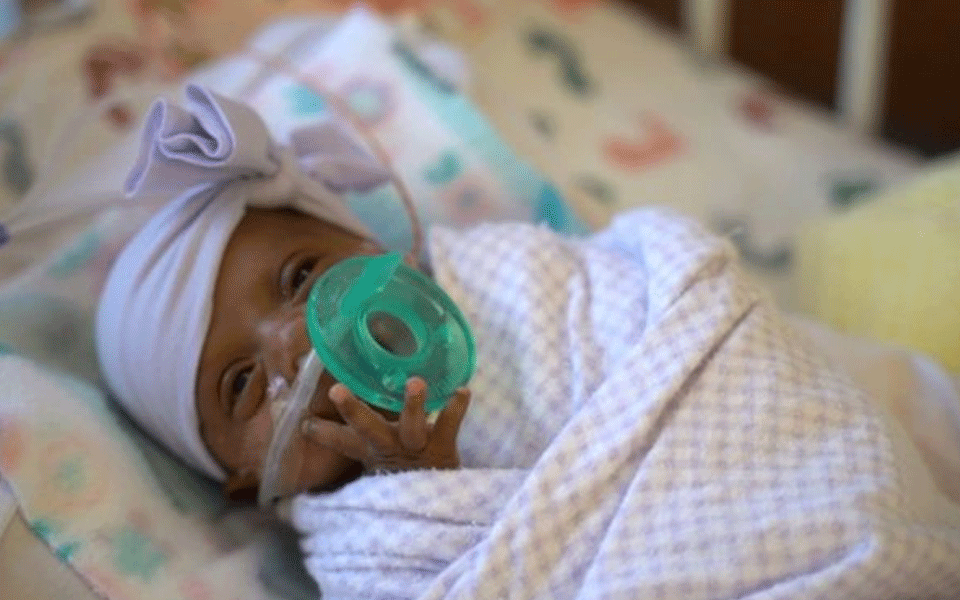 World’s ‘tiniest baby’, weighing 245 grams, released from US hospital